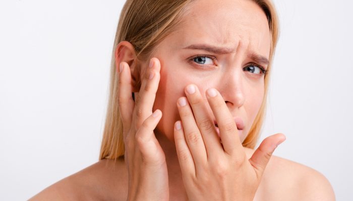 a girl who is sad and tensed about her dry skin